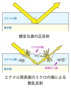 歯のつや
