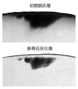 再石灰化