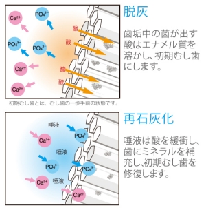 脱灰と再石灰化