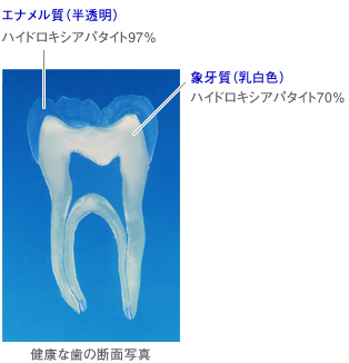 健康な歯の断面写真